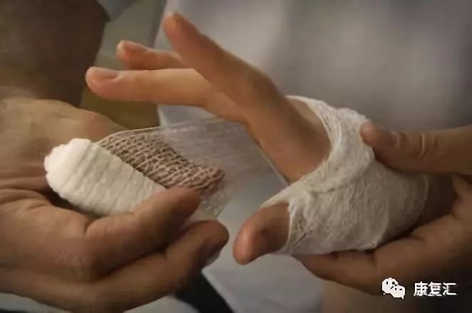 「健康科普」常见伤口处理,书上不讲的技巧