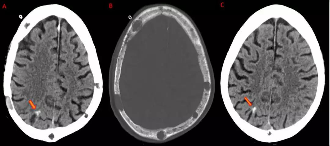 神经影像,神经影像解剖图