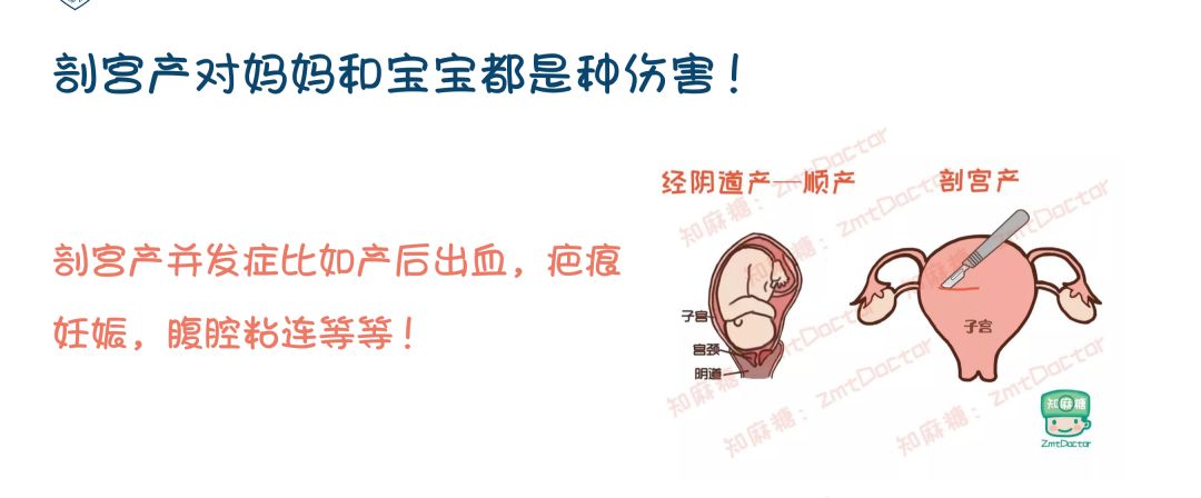 给孕妈妈最好的礼物是什么,给孕妇妈妈的实用的礼物