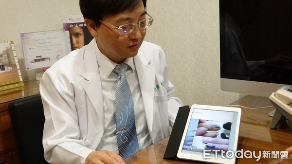 指头发黑坏死是怎么回事,指头紫发黑怎么回事