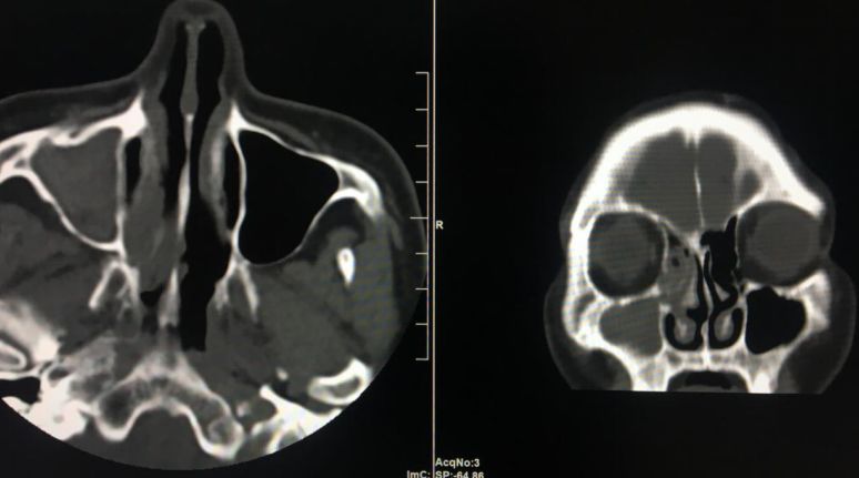 蒙自第一人民医院中医科,蒙自市中医院专家门诊