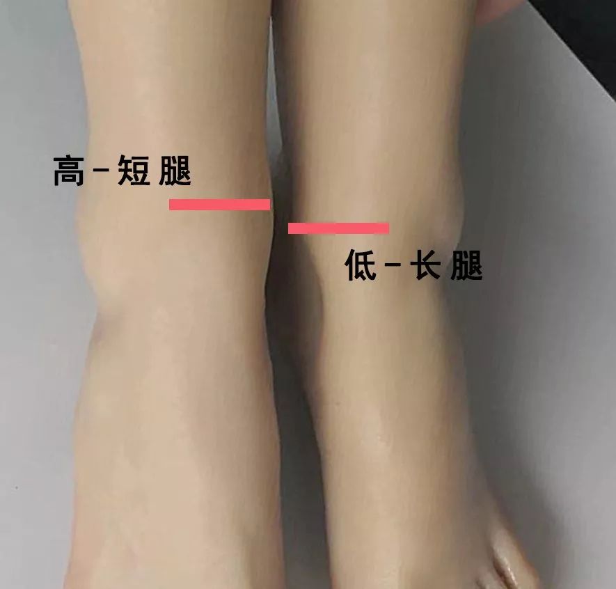 三招矫正长短腿,长短腿懒人矫正法