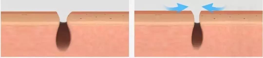 柔嫩抛光|脸上搓出3斤泥！难怪又黄又暗又黑头！10秒给脸蛋“剥壳”，厉害