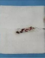 26岁小伙熬夜头晕,28岁小伙熬夜加班49小时