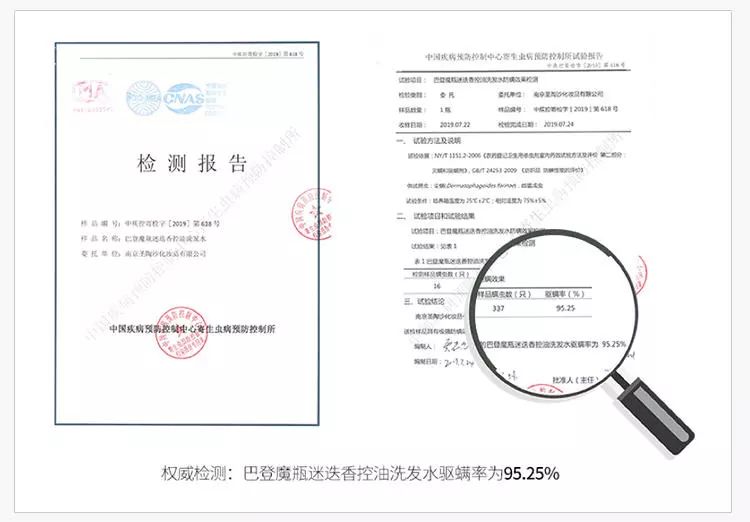 头皮痒头屑多有头螨怎么办,头螨大块头屑怎么治好得快