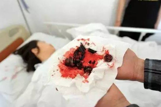 办公室的椅子突然爆炸,办公椅子容易爆炸