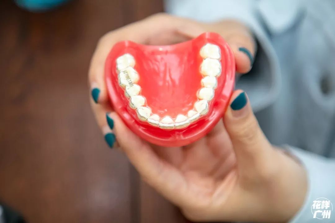 种牙免费送,种牙优惠活动免费检查是真的吗