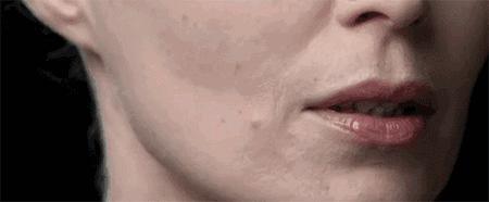 线雕抗衰老的方法,线雕改变了脸型丑死了咋办