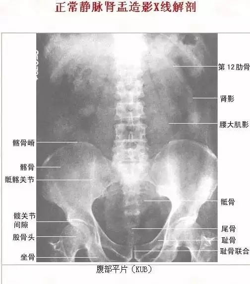 足正常x线解剖图解,常规x线影像解剖图怎么看