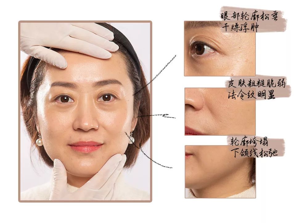 地表最强修复肌肤屏障,地表最强肌诊室