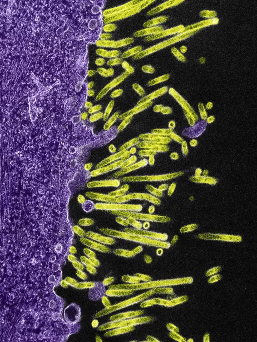 鍋囧鐥呮瘨鎰熸煋浜嗕綘,鍋囧鐥呮瘨鎰熸煋浜嗘垜