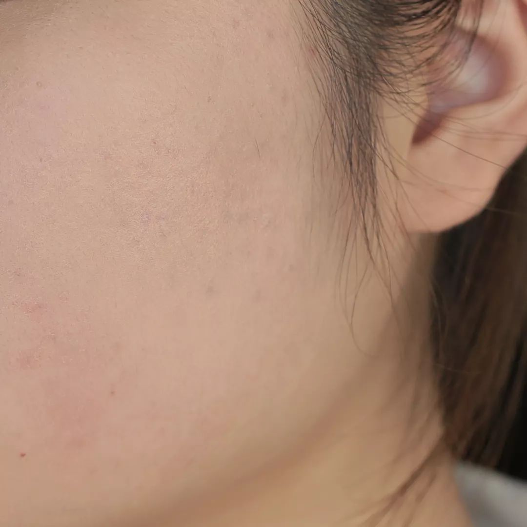 平价气垫遮瑕持久排行榜前十名,8款热门平价遮瑕测评瑕疵皮救星