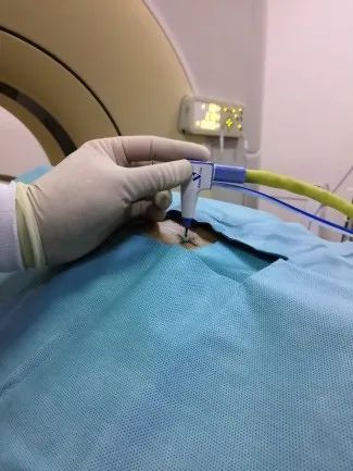 在线心内会诊室丨原醛治疗,“柳暗花明又一村”