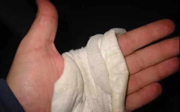 儿童开水烫伤急救处理,被开水烫伤怎么办最快最有效