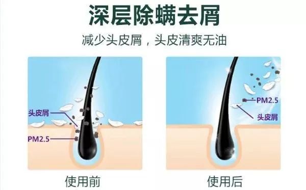 头上的螨虫用什么方法消除,头上又油又痒