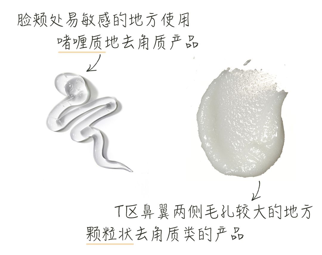 戴口罩脸上长闭口粉刺怎么办,戴口罩鼻子起痘长闭口