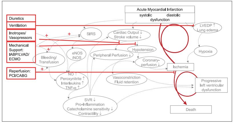 心梗引起的心源性休克,急性心梗合并心源性休克
