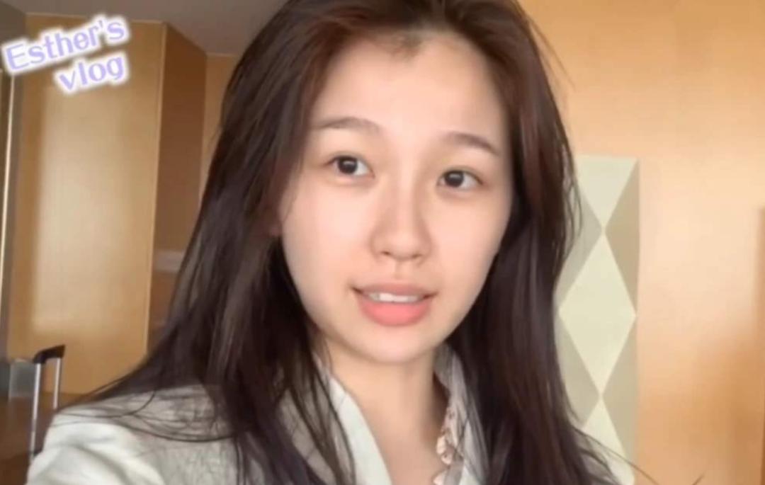 虞书欣手表100多万 (虞书欣医美费用)