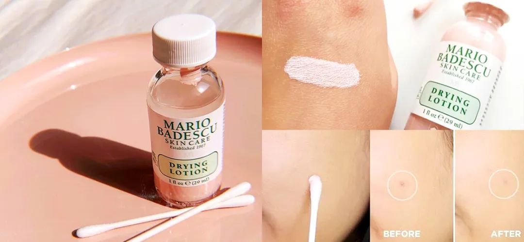 为什么戴上口罩会闷痘,为什么戴口罩就长痘