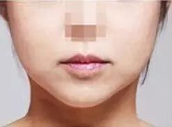 脸大有什么方法简便而快速的瘦脸,脸大瘦脸方法有用吗