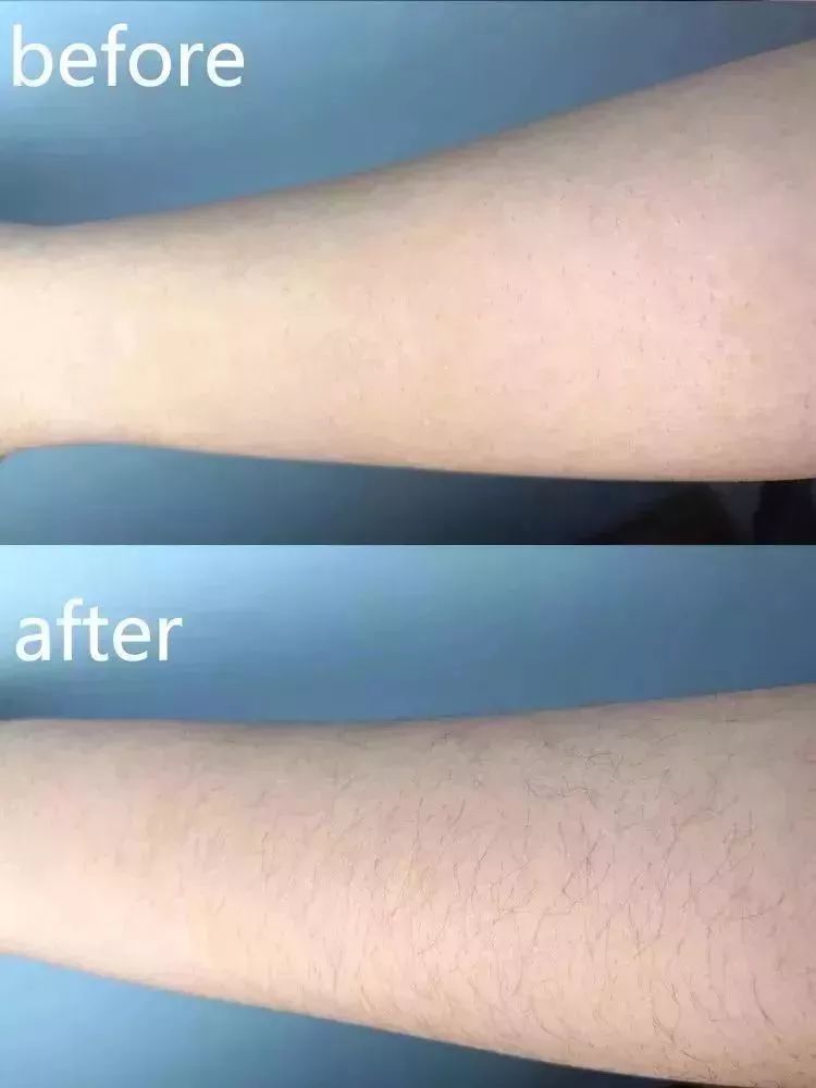 永久脱毛膏既好用又便宜,脱毛膏好用还是刮毛刀好用呢