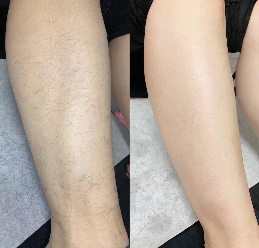 永久脱毛膏既好用又便宜,脱毛膏好用还是刮毛刀好用呢