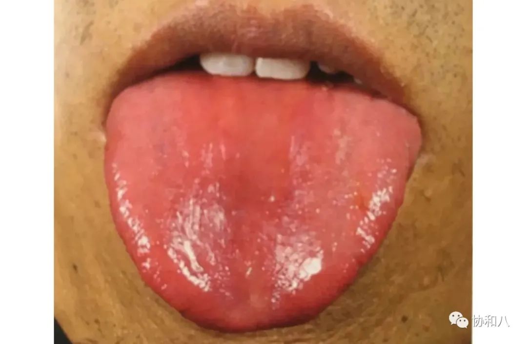 复习这些名解时总觉得怪饿的|协和八·脑洞大开