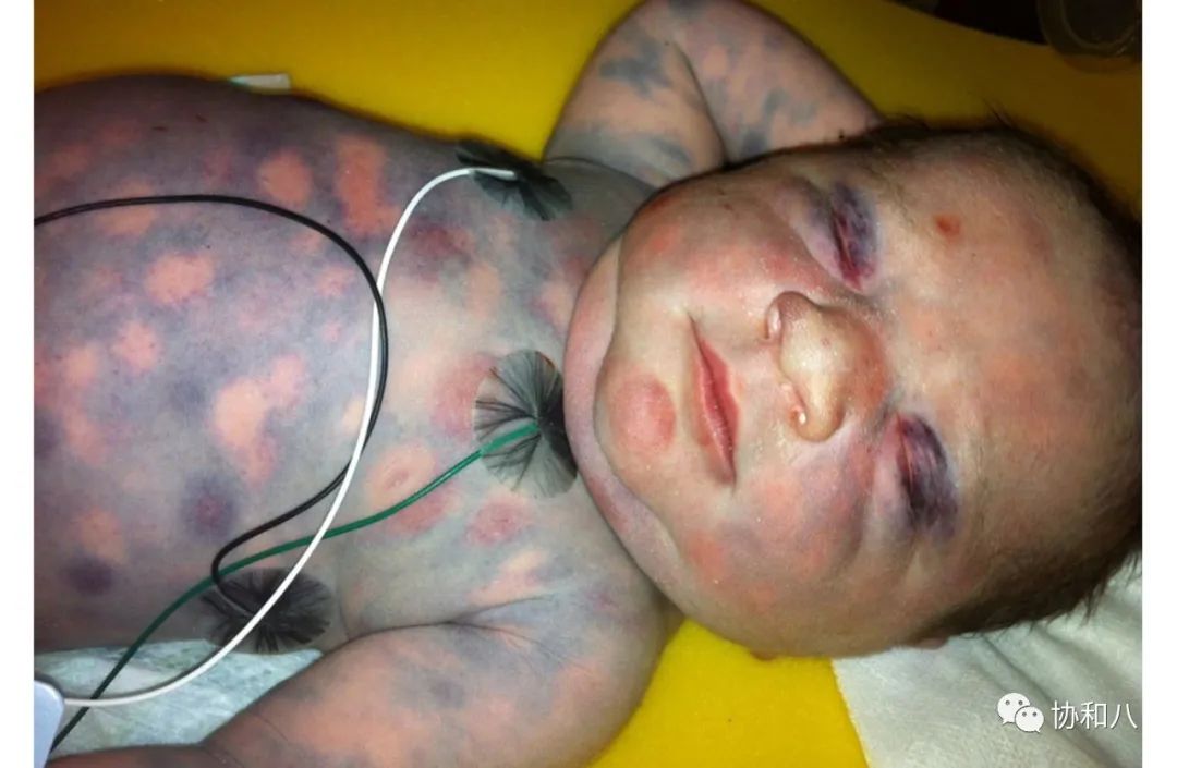 复习这些名解时总觉得怪饿的|协和八·脑洞大开