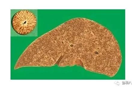 复习这些名解时总觉得怪饿的|协和八·脑洞大开