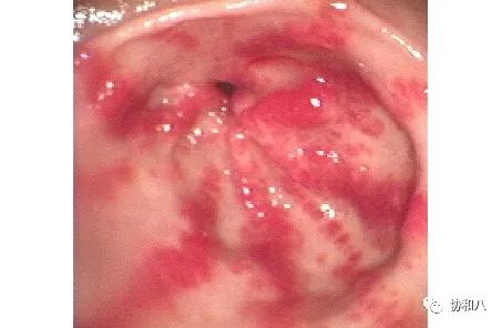 复习这些名解时总觉得怪饿的|协和八·脑洞大开