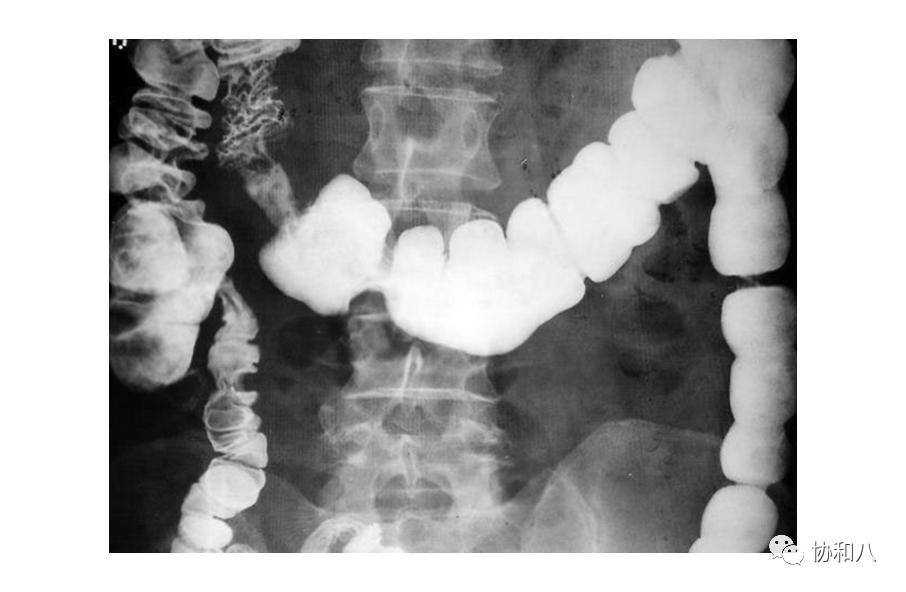 复习这些名解时总觉得怪饿的|协和八·脑洞大开