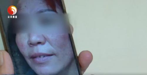 琼海玲珑梵宫毁容事件频出,玲珑梵宫怎样维权退款