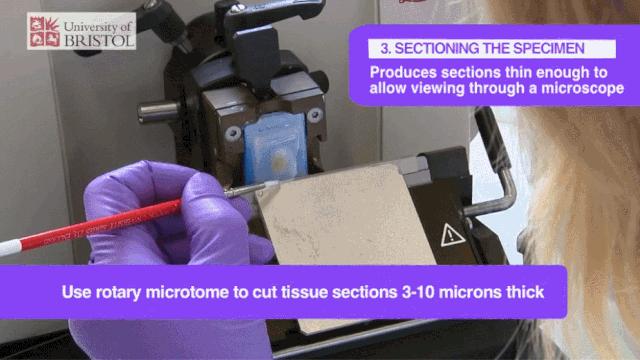 探秘病理科,病理科活检为什么慢