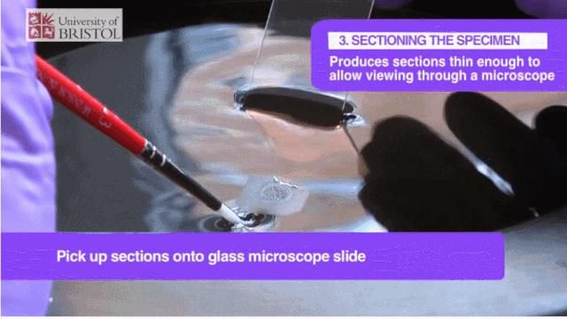 探秘病理科,病理科活检为什么慢