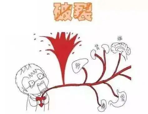 胸部手术局部麻醉打哪里,胸科手术麻醉风险