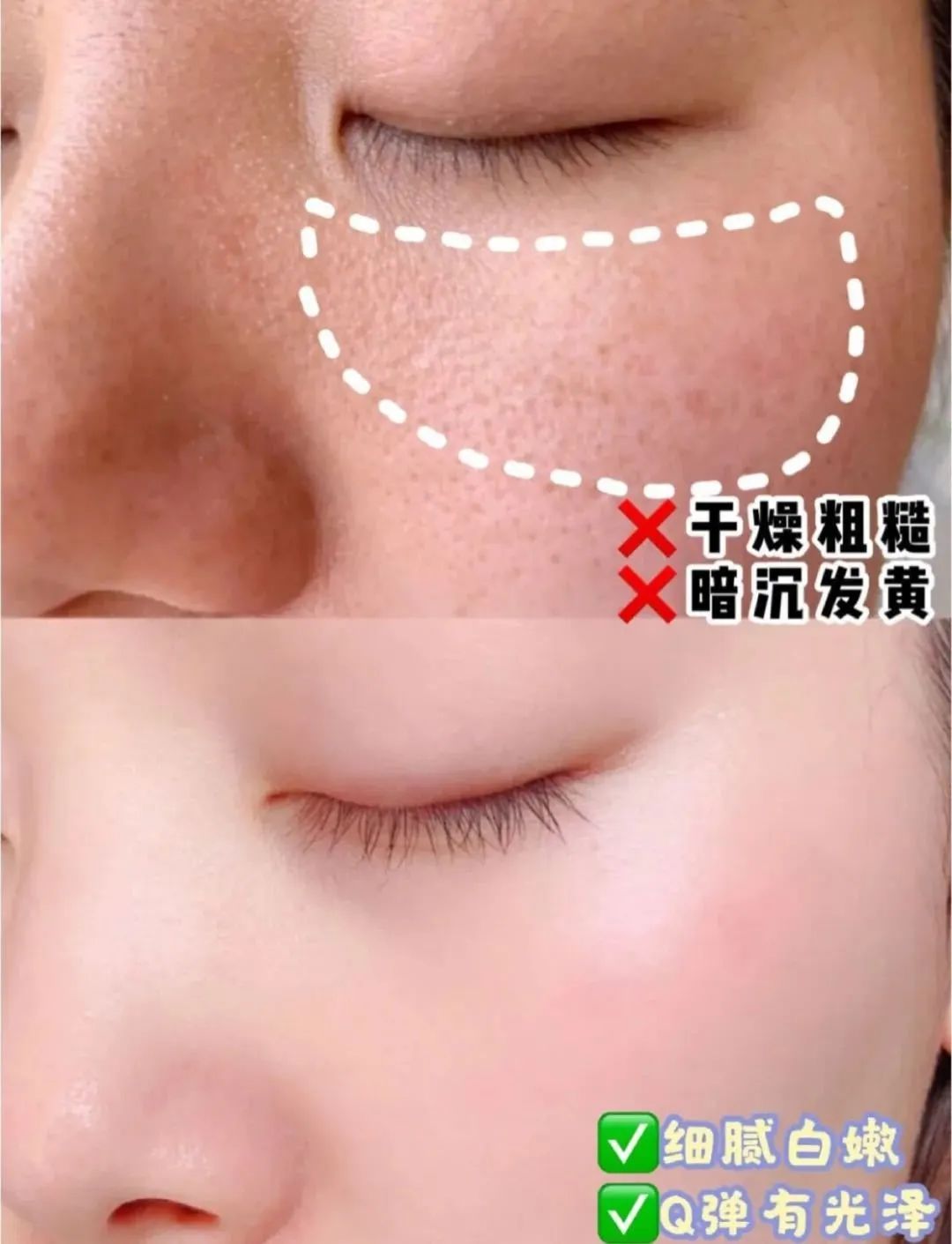 洗出脸上的脏东西解压,清除脸上斑块的产品