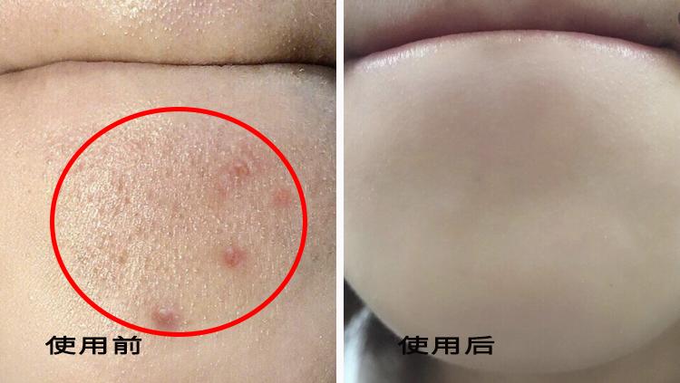 洗出脸上的脏东西解压,清除脸上斑块的产品