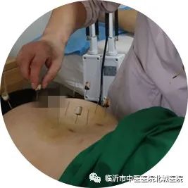 临沂市中医院医保门诊报销政策,不用医保也能报销的医院