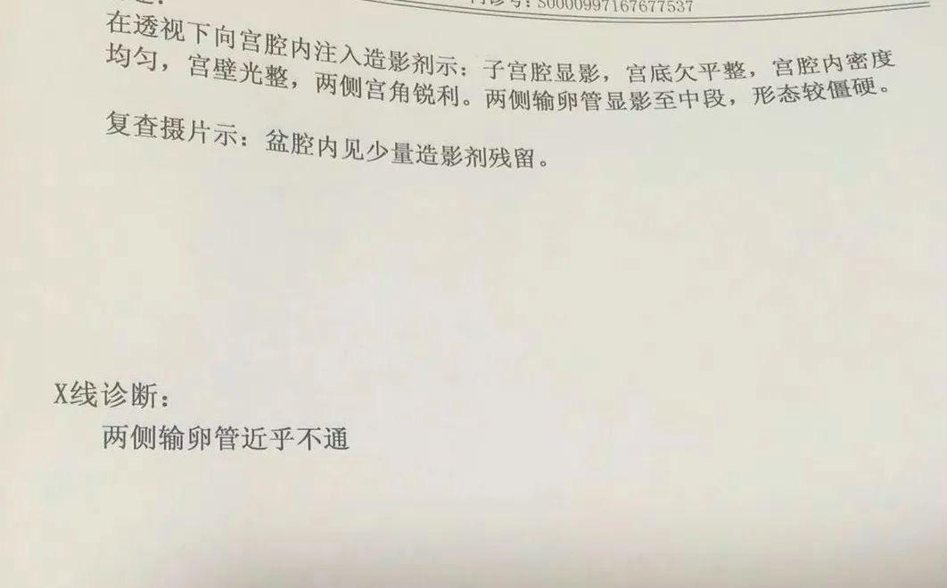 当取卵针戳进我的卵巢时，丈夫在看片取精|成为母亲