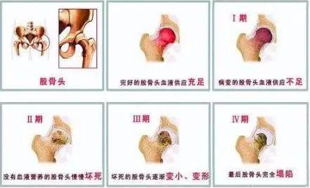 上海六院骨科专家刘万军预约挂号,上海六院骨科专家刘万军出诊时间