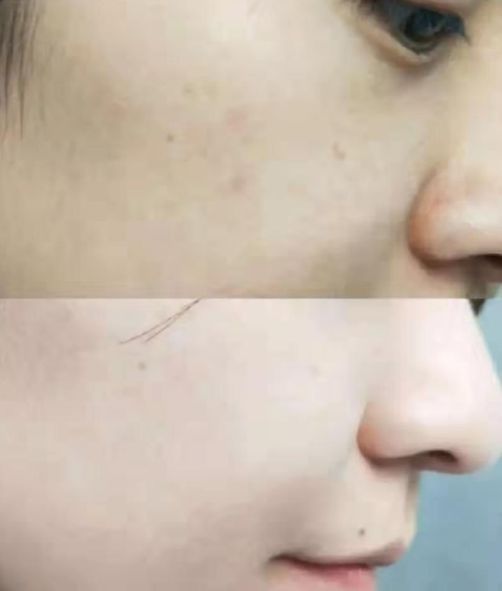 喝胶原蛋白要坚持多久才能有效果,紧急提醒经常喝这个的人要注意了