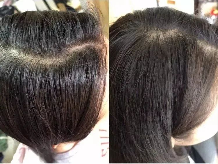 长期补充胶原蛋白的人怎么样了,长期喝胶原蛋白的人最后怎么样了