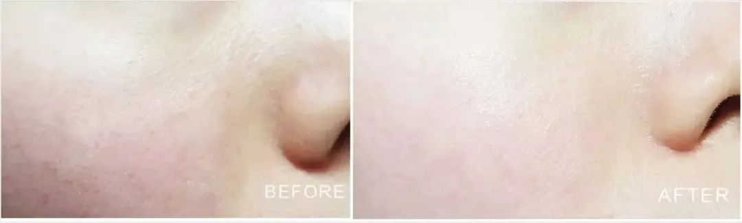 长期补充胶原蛋白的人怎么样了,长期喝胶原蛋白的人最后怎么样了