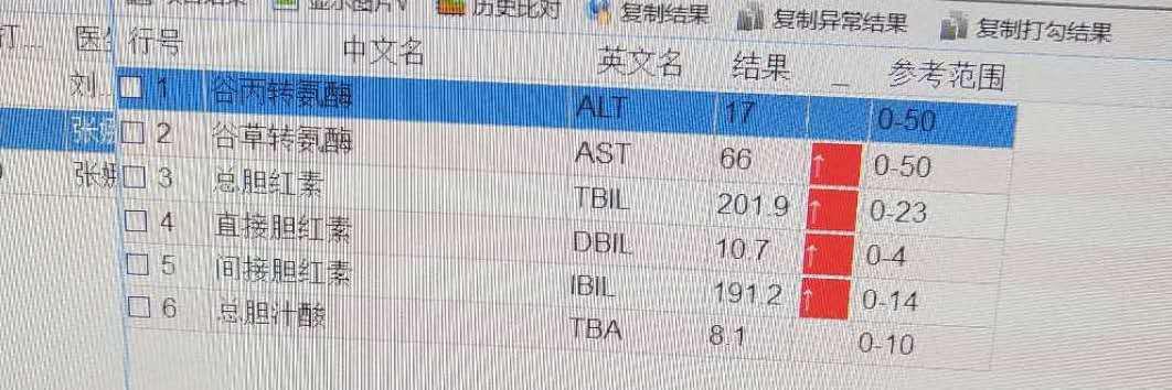 新生儿黄疸高是吃药还是照蓝光,新生儿黄疸160需要吃药吗