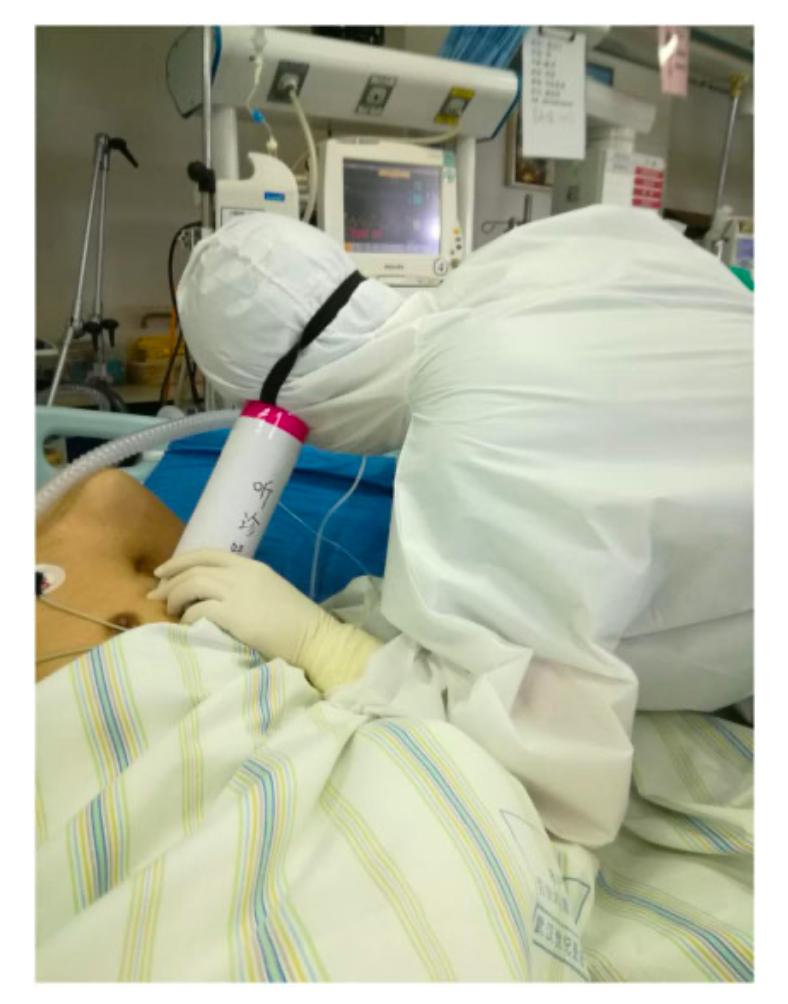 吃完就扔的“薯片筒”，被中国医生拿来发了篇医学顶刊论文