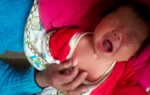 19岁女孩乳头一直没长出来父母后悔听信“老人言”