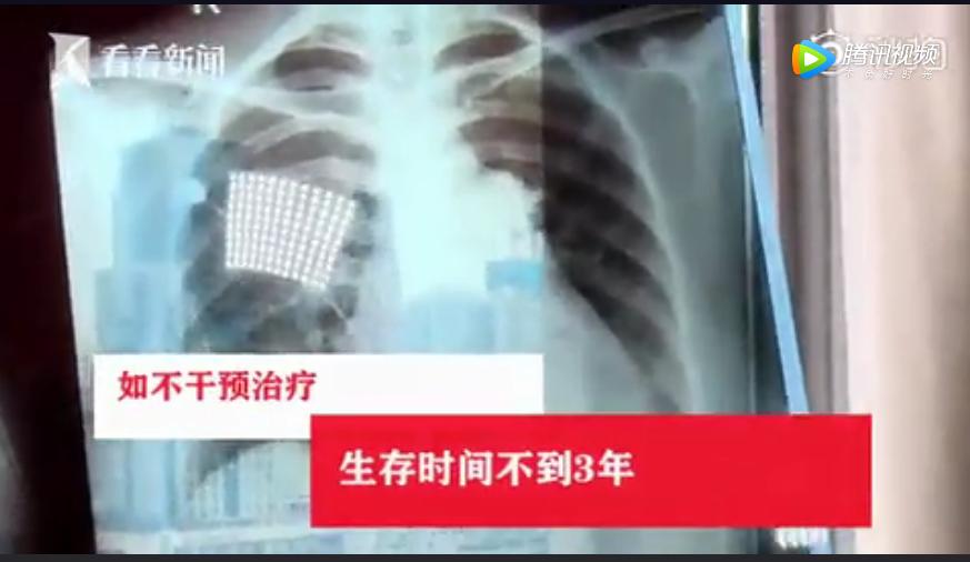 “我23岁，包里装满了纸尿裤”：那些被减肥毁掉的中国女孩们