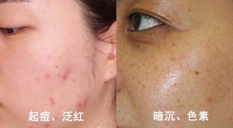 pony使用的底妆,pony化妆从洗脸开始