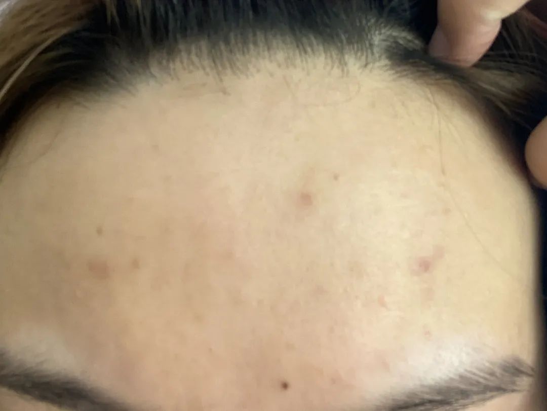 百人测评团|蒸笼天里,想让肌肤“一秒入水”,可能吗?