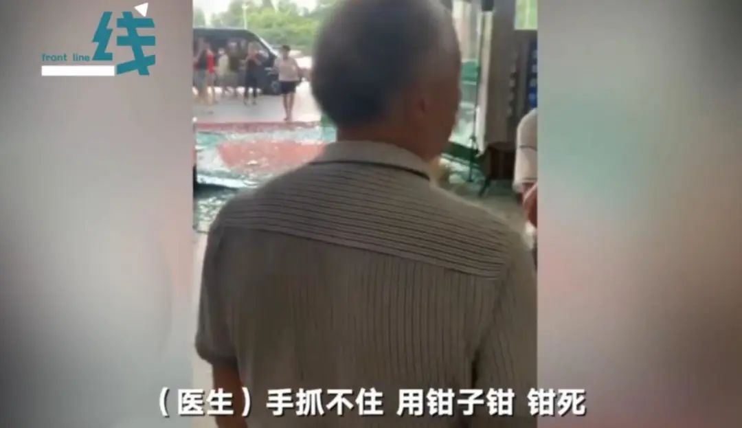 宝宝出生被产钳夹死,产钳夹出来的孩子后遗症有哪些